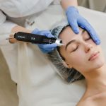 Flawless Skin with Pico Laser