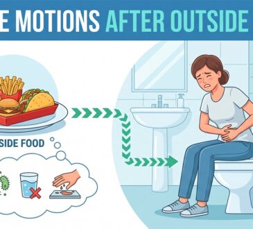 loose motions after outside food