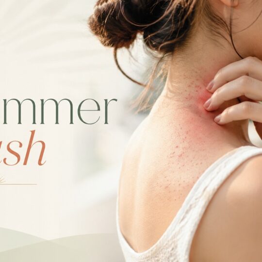 summer rash causes